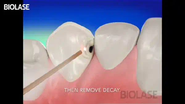 Vimeo video 207116749