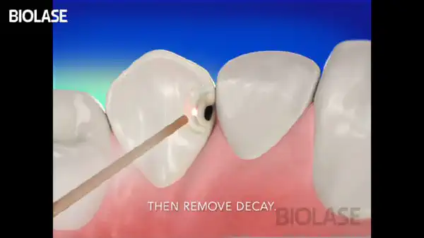 Vimeo video 207116749