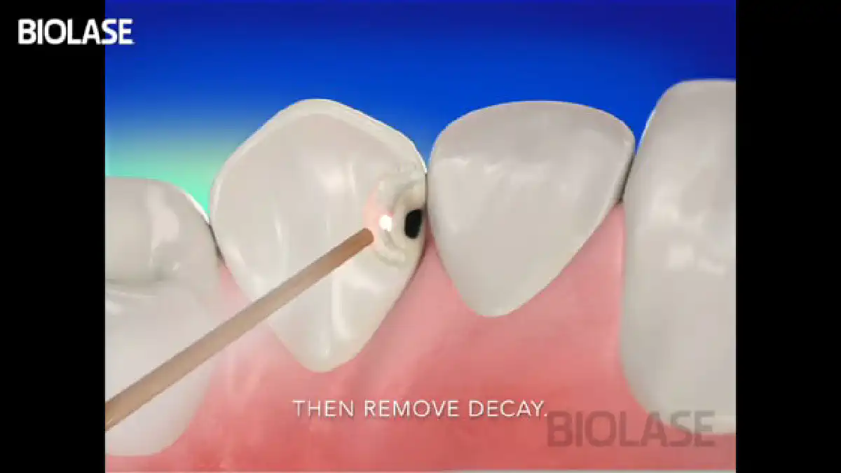 Vimeo video 207116749