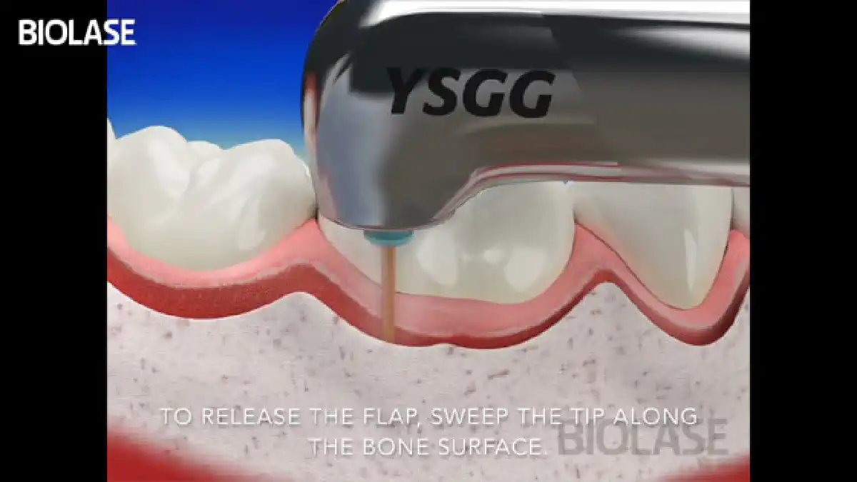 Vimeo video 207017168