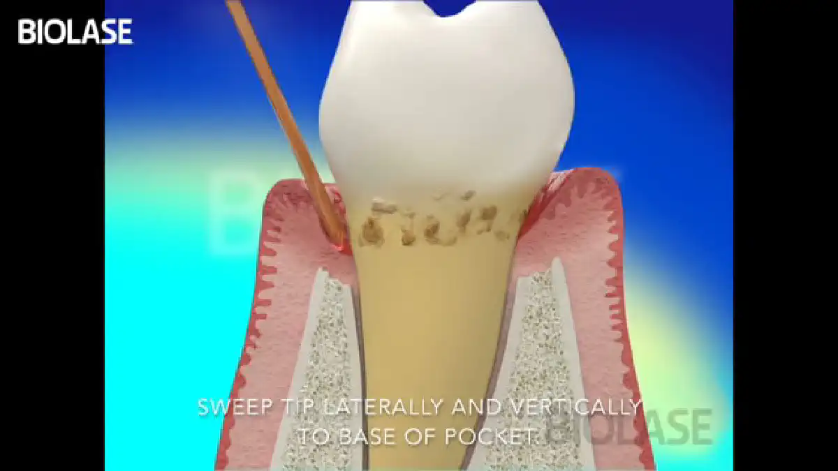 Vimeo video 207013432