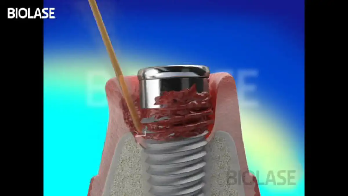 Vimeo video 207121157