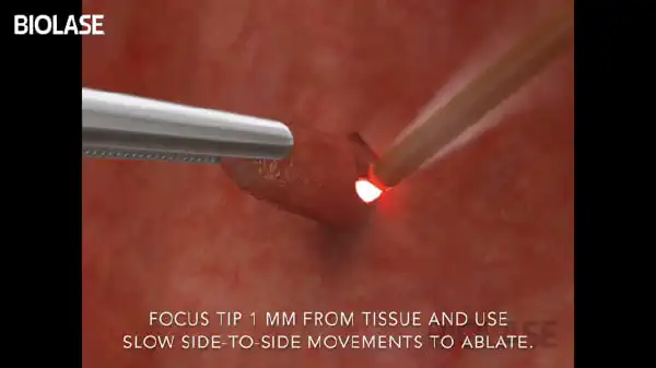 Vimeo video 207020787