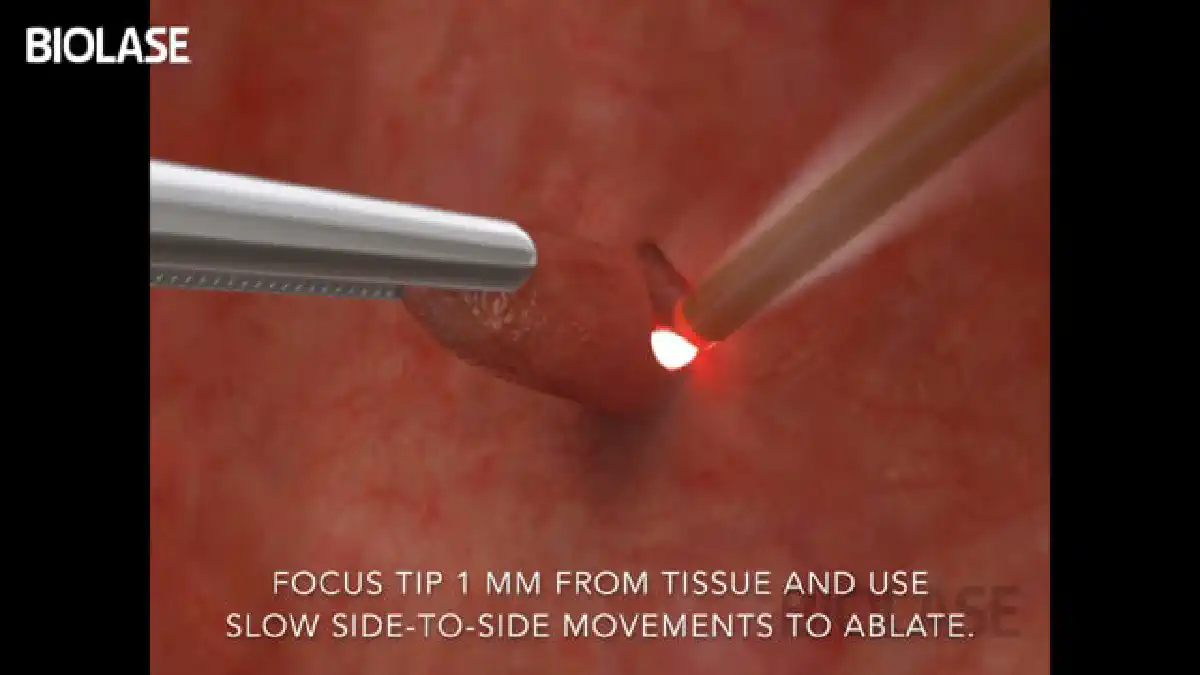 Vimeo video 207020787