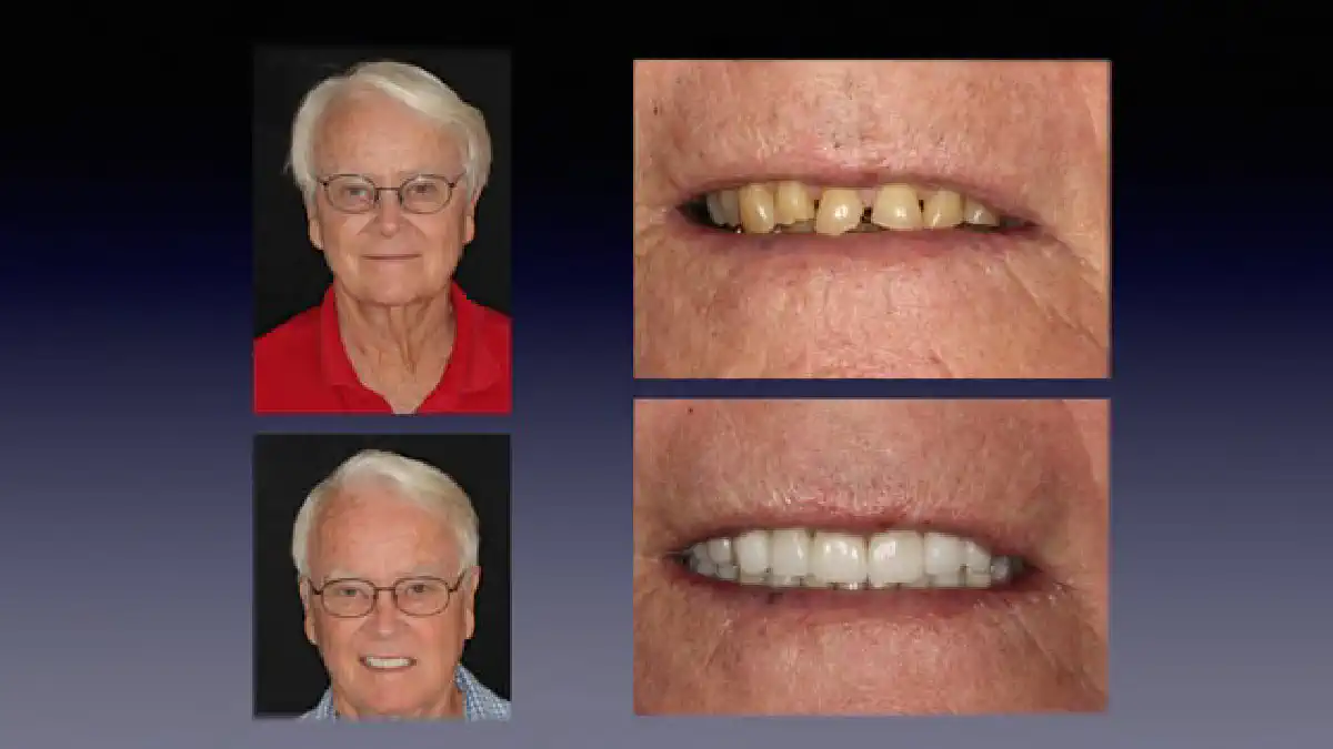 Vimeo video 281522492