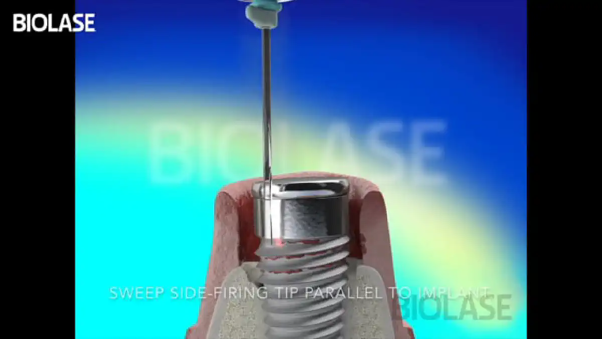 Vimeo video 284420938