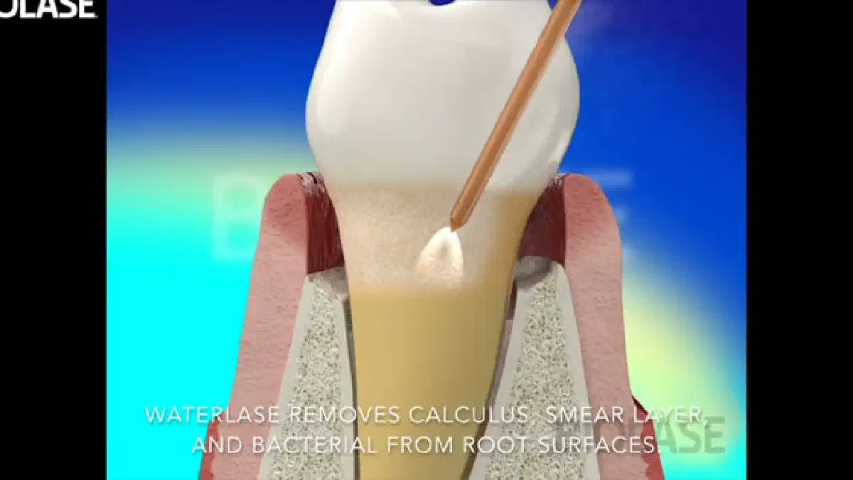 Vimeo video 284420778