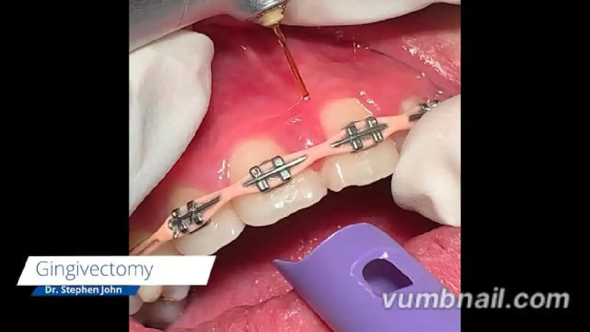 Vimeo video 736663839