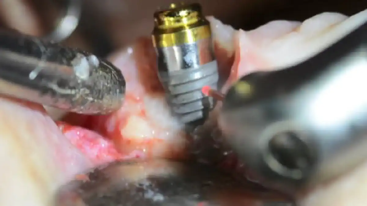 Vimeo video 310874740