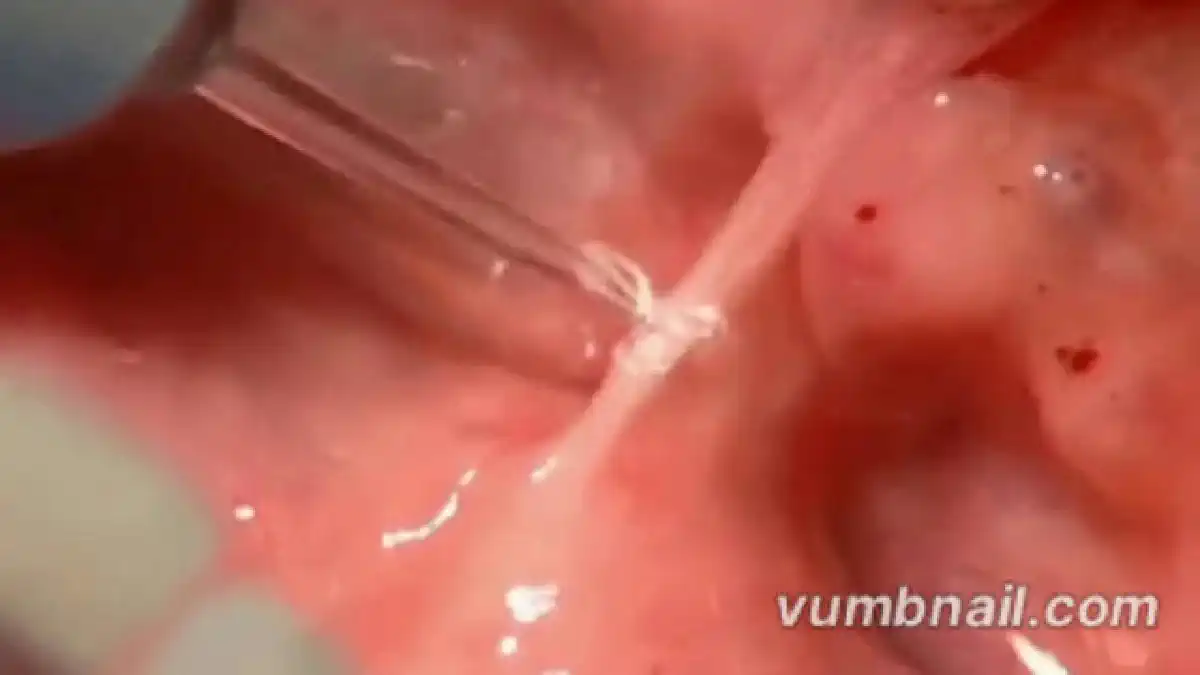 Vimeo video 82583146