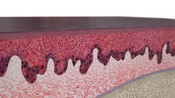 Vimeo video 387007319