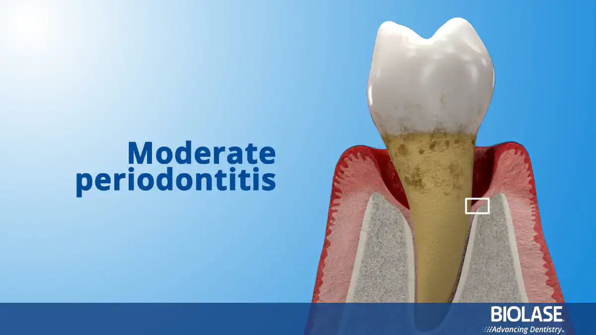 Vimeo video 476331966